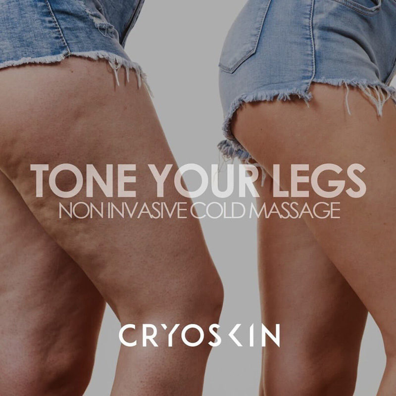 Cryoskin Toning